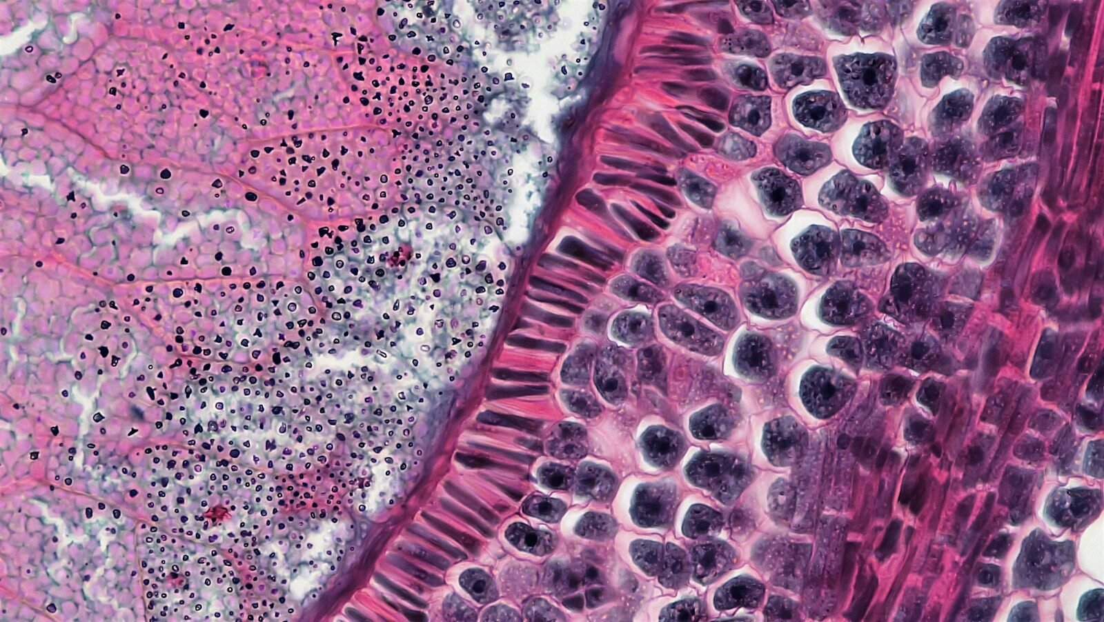 Cutaneous squamous cell carcinoma: UNLOXCYT’s long-term data